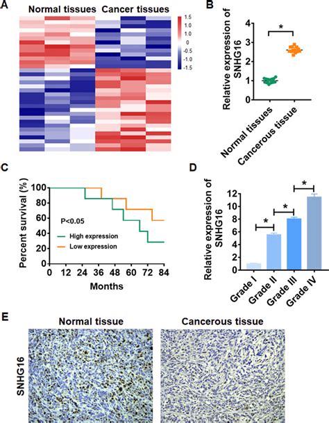 The Expression Of Lncrna Snhg16 In Glioma Tissues A Lncrna Expression