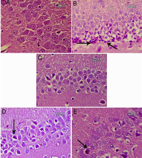 Representative photomicrographs of rat hippocampus after treatment with ... 