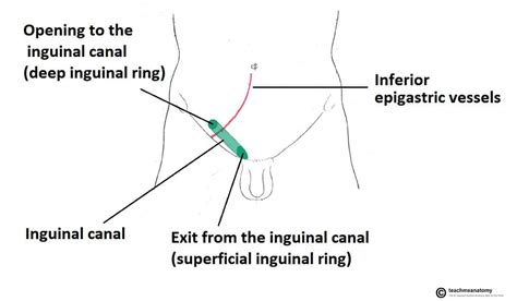 Female Inguinal Hernia Anatomy