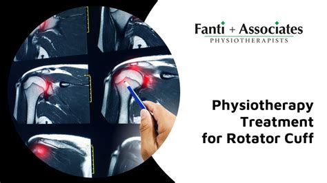 Relieve Your Rotator Cuff Pain Through Physiotherapy