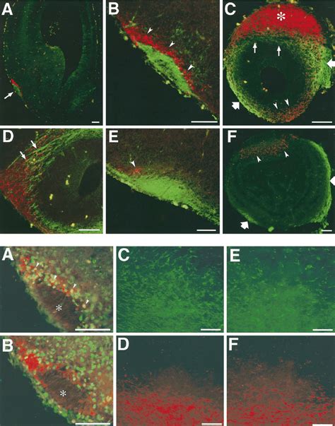 Top Lot Cells And Mitral Cell Axons In Telencephalon Sections All