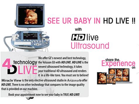 Miracle View Ultrasound