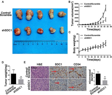 Syndecan 1 Knockdown Inhibits Glioma Cell Proliferation And Invasion By