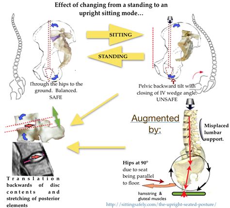 Back Rests Pelvic Support V Lumbar Sitting Safely