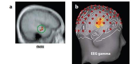 Que se passe t il dans le cerveau quand vous avez une idée Sciences