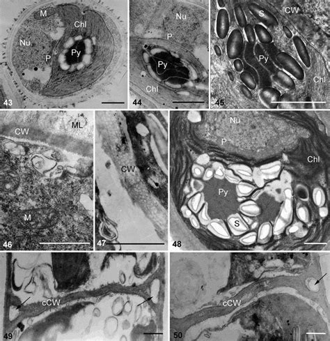 Transmission Electron Micrographs Of Vegetative Cells And Cell Wall