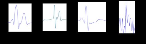 The Pre Processed ECG Heartbeats After Applying The Preprocessing Chain