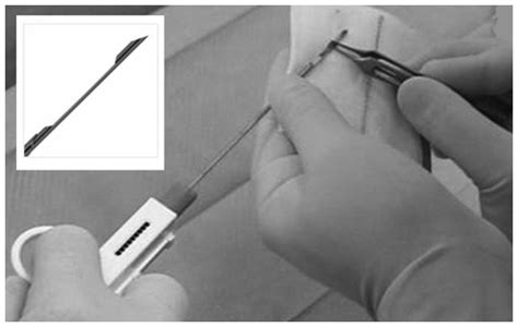 A Method For The Ultrastructural Preservation Of Tiny Percutaneous