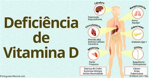 Endocrinologista Esclarece 5 Dúvidas Sobre A Vitamina D Saúde