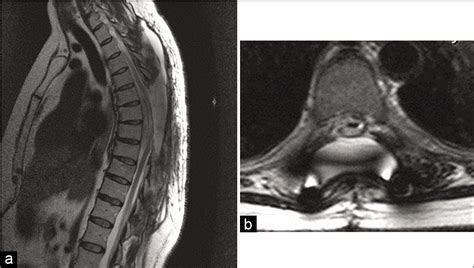 Surgical Neurology International