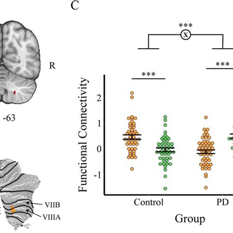 Regions Of Higher Connectivity With Sn Than Vta Whole Brain Download Scientific Diagram