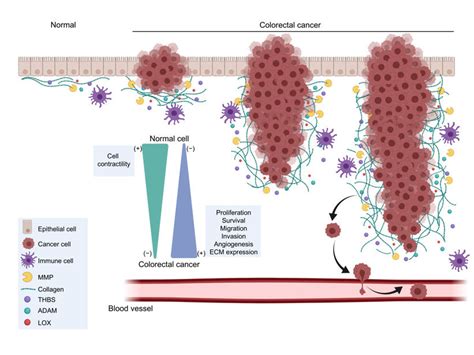 A Simplified Diagram Of Extracellular Matrix Biomarkers Differentially