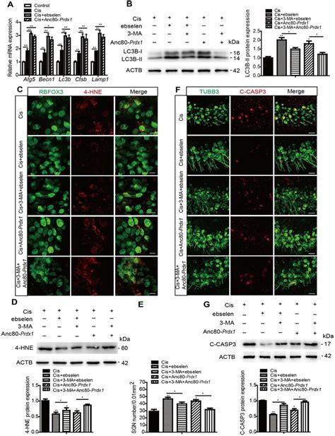 Ebselen And Overexpression Of Prdx Protect Against Cisplatin Induced