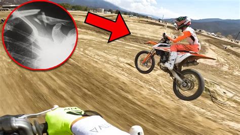 Dirt Bike Crash At Fox Raceway Broken Collar Bone Youtube