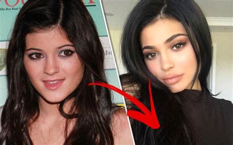 Kylie Jenner Slams Plastic Surgery Rumors Reveals A Good Reason Her