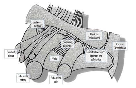 Thoracic Outlet Syndrome Vascular Services