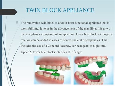 Functional Appliances Ppt