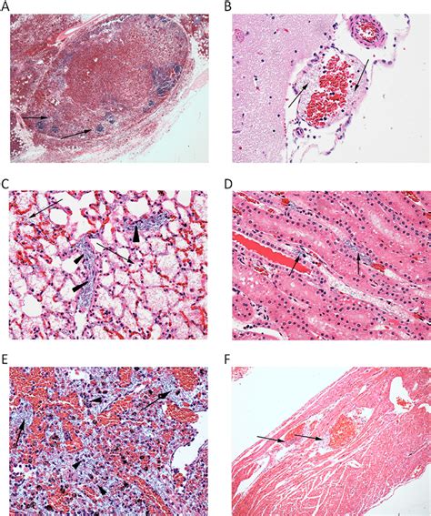 Histopathological Findings Tissue Samples Were Preserved In 10