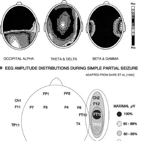 EEG changes during simple partial seizures (SPS). (A) Topographic maps ...