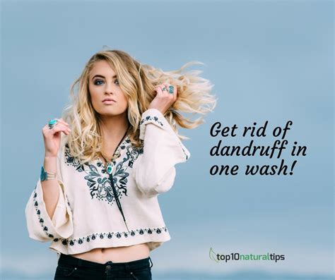 Top 10 Natural Remedies To Get Rid Of Dandruff In One Wash Top10