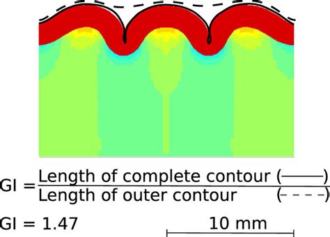 Gyrificaiton Index To Quantify Cortical Folding The Gyrification Index