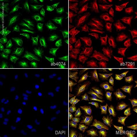 Anti Alpha Tubulin Antibody Loading Control Ab Abcam