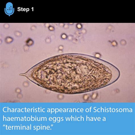 Schistosoma Haematobium