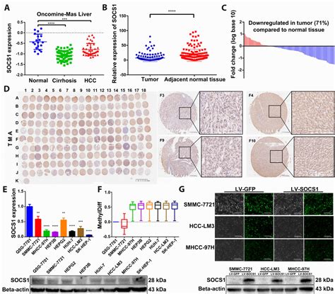 SOCS1 Blocks G1 S Transition In Hepatocellular Carcinoma By Reducing