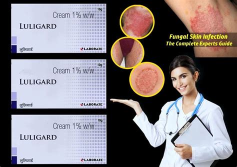 Luligard Luliconazole Cream Packaging Size 15 Gm At Rs 299 Piece In