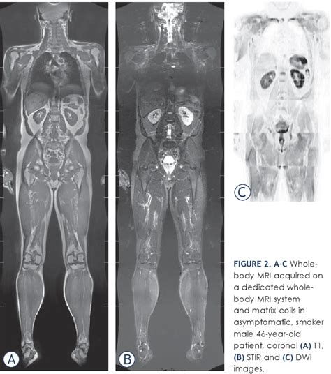 Figure 1 From Clinical Value Of Whole Body Magnetic Resonance Imaging