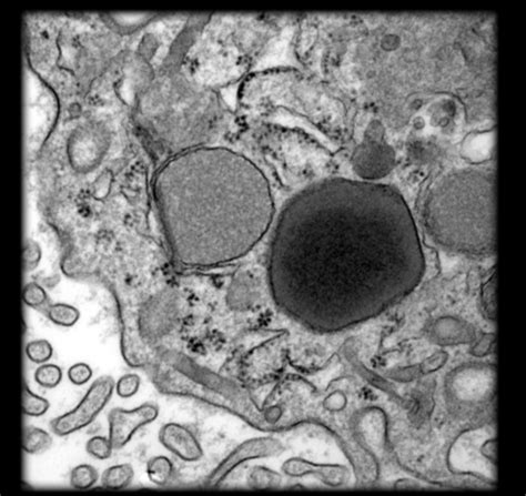 Endoplasmic Reticulum Microscope