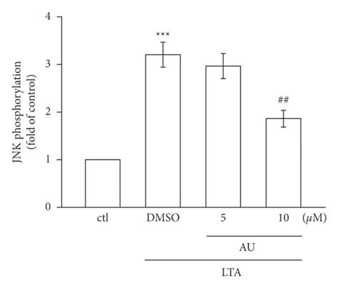 Effects Of Au In Lta Induced Phosphorylation Of Mapks In Raw