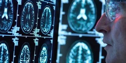 Türk doktordan çığır açan buluş Alzheimer riskini düşürecek geni keşfetti