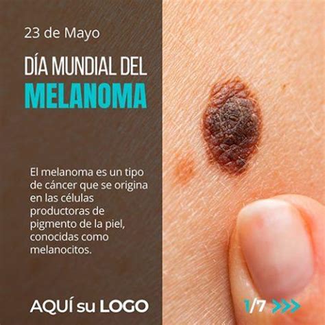 Mayo D A Mundial Del Melanoma Farmacanva