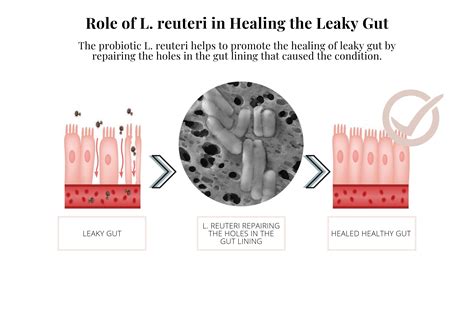 The Vital Role Lactobacillus Reuteri Plays In Your (and Your Babies ...