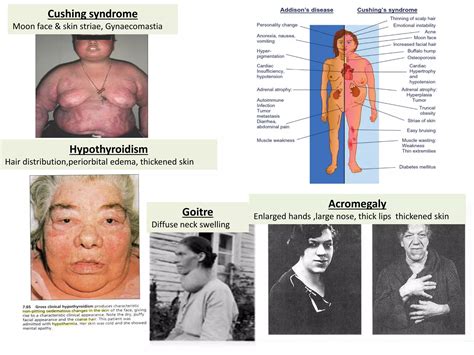 History Taking Clinical Assessment Of Endocrine System Pdf