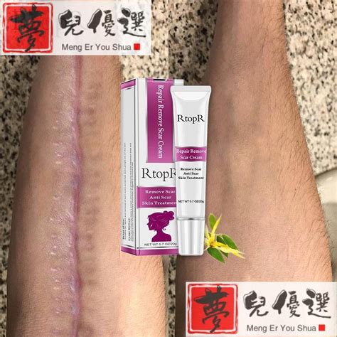 Acne Scar Stretch Marks Remover Face Cream Skin Repair 蝦皮購物