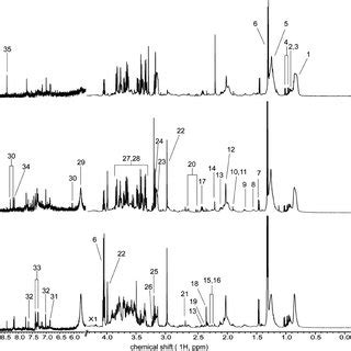 Representative 600 MHz 1 H NMR Spectra Obtained From Serum Homogenates