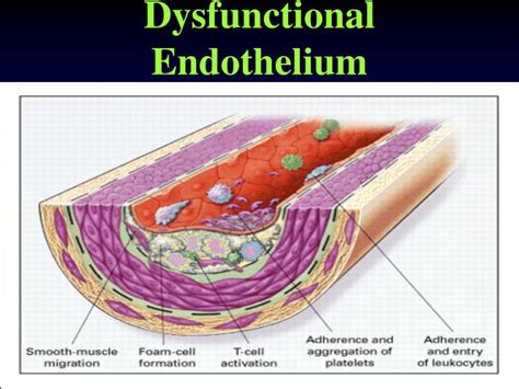 Ppt Endothelial Dysfunction In Hypertension Powerpoint Presentation Id 828396