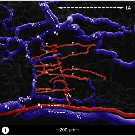 The Vasa Vasorum Run Predominantly Parallel To The Longitudinal Axis Download Scientific