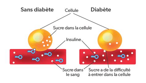 Quest Ce Que Le Diabète Diabète Québec