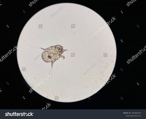 Otodectes Cynotis Ear Mites Under Microscope Stock Photo 2202626431