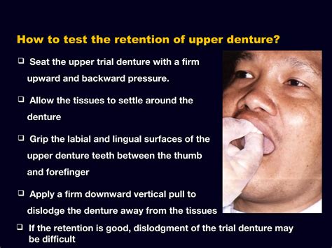 7 Try In Of The Wax Trial Complete Denture Ppt