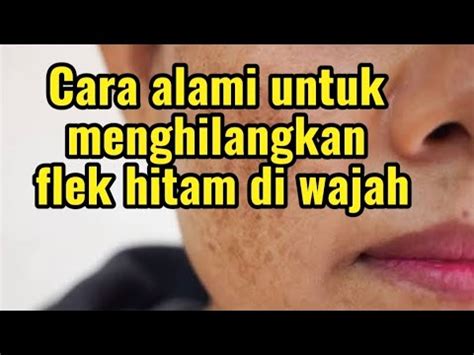 Cara Alami Untuk Menghilangkan Flek Hitam Diwajah Youtube