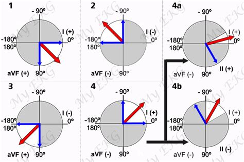 Ecg Axis Chart A Visual Reference Of Charts Chart Master