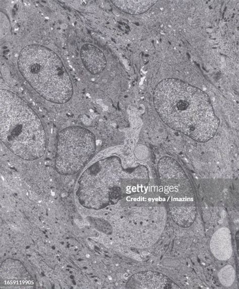 29 Langerhans Cells Stock Photos, High-Res Pictures, and Images - Getty Images