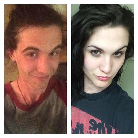 26 Mtf 19 Months Hrt Before And After Transtimelines