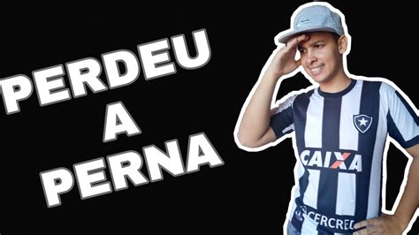 Jogadores Que Fraturaram A Perna Cenas Fortes Youtube