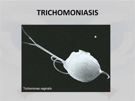 Ppt Trichomoniasis Powerpoint Presentation Free Download Id6728626