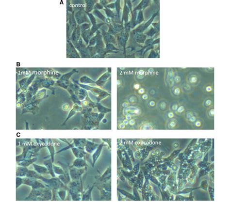 Light Microscopy Of Untreated And Opioid Treated Sh Sy Y Cells A